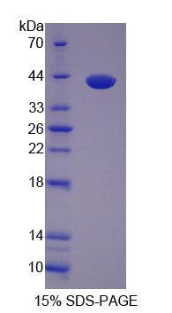 Recombinant Ankyrin Repeat Domain Protein 1 (ANKRD1)