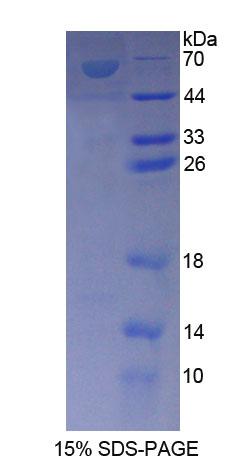 Recombinant Ankyrin Repeat Domain Protein 1 (ANKRD1)