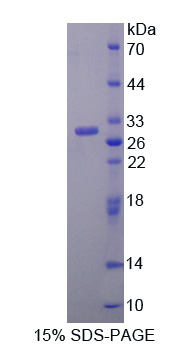 Recombinant Vasorin (VASN)