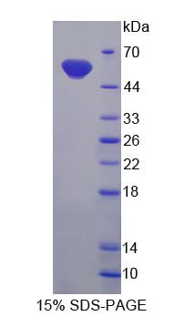 Recombinant UDP Glucuronosyltransferase 2 Family, Polypeptide B7 (UGT2B7)