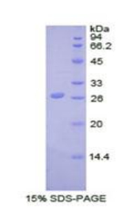 Recombinant Ubiquitin Carboxyl Terminal Hydrolase L5 (UCHL5)