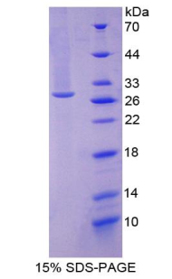 Recombinant Ubiquitin Carboxyl Terminal Hydrolase L1 (UCHL1)