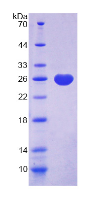 Recombinant Ubiquitin Carboxyl Terminal Hydrolase L1 (UCHL1)