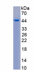 Recombinant Ubiquitin Carboxyl Terminal Hydrolase L1 (UCHL1)