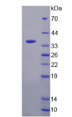 Recombinant Thymidylate Synthetase (TYMS)