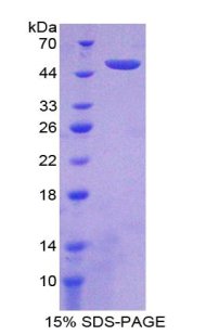 Recombinant Interferon Alpha 21 (IFNa21)