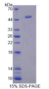 Recombinant Interferon Alpha 5 (IFNa5)