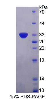 Recombinant TTK Protein Kinase (TTK)