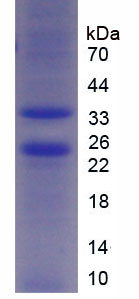 Recombinant TTK Protein Kinase (TTK)