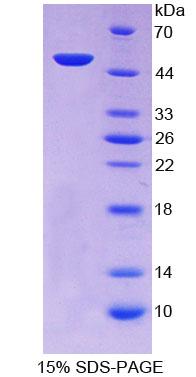 Recombinant Thyroid Hormone Receptor Interactor 6 (TRIP6)