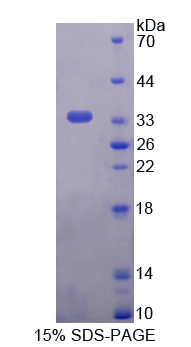 Recombinant Triosephosphate Isomerase 1 (TPI1)