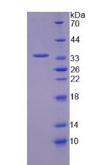 Recombinant Transketolase (TKT)