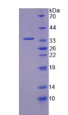 Recombinant Transketolase (TKT)