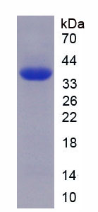 Recombinant Toll Like Receptor Adaptor Molecule 1 (TICAM1)