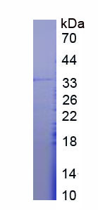 Recombinant Zinc Finger Homeobox Protein 1A (ZFHX1A)