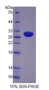 Recombinant Sulfite Oxidase (SUOX)