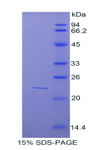 Recombinant Sulfite Oxidase (SUOX)