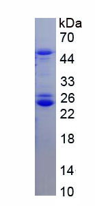 Recombinant Serine/Threonine Kinase 3 (STK3)