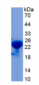 Recombinant Stress Induced Phosphoprotein 1 (STIP1)