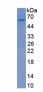 Recombinant Six Transmembrane Epithelial Antigen Of The Prostate 2 (STEAP2)