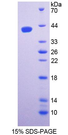 Recombinant Serine Palmitoyltransferase, Long Chain Base Subunit 1 (SPTLC1)