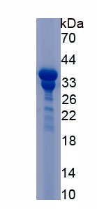 Recombinant Serine Peptidase Inhibitor Kazal Type 5 (SPINK5)