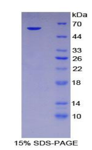 Recombinant Serine Peptidase Inhibitor Kazal Type 5 (SPINK5)