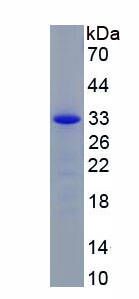 Recombinant Suppressors Of Cytokine Signaling 5 (SOCS5)