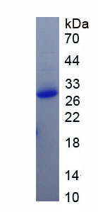 Recombinant Small Nuclear Ribonucleoprotein 70kDa (SNRNP70)
