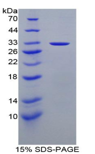 Recombinant Stratifin (SFN)