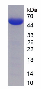 Recombinant SET Binding Protein 1 (SETBP1)