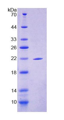 Recombinant Suprabasin (SBSN)