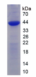 Recombinant Receptor Activity Modifying Protein 2 (RAMP2)