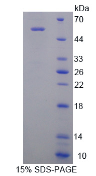 Recombinant Renal Tumor Antigen (RAGE)