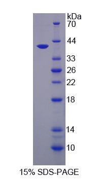 Recombinant Glutaminyl Peptide Cyclotransferase (QPCT)