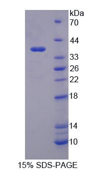 Recombinant Pregnancy Specific Beta-1-Glycoprotein 2 (PSG2)