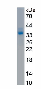 Recombinant Protamine 1 (PRM1)