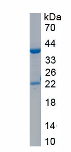 Recombinant Periplakin (PPL)