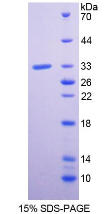 Recombinant Plexin A1 (PLXNA1)