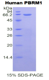 Recombinant Polybromo 1 (PBRM1)