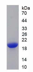 Recombinant Polybromo 1 (PBRM1)