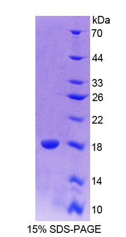 Recombinant Paired Box Gene 6 (PAX6)