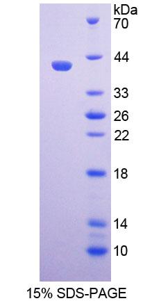 Recombinant Paired Box Gene 9 (PAX9)