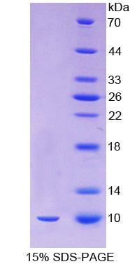 Recombinant OCM