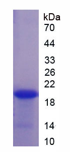 Recombinant Nucleolar And Spindle Associated Protein 1 (NUSAP1)
