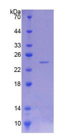 Recombinant Neuropathy Target Esterase (NTE)