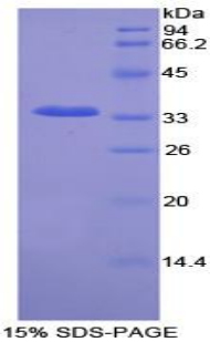 Recombinant Never In Mitosis Gene A Related Kinase 2 (NEK2)