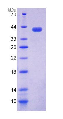 Recombinant Nucleosome Assembly Protein 1 Like Protein 1 (NAP1L1)