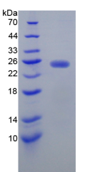 Recombinant N-Acetylgalactosaminidase Alpha (NAGa)