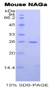 Recombinant N-Acetylgalactosaminidase Alpha (NAGa)